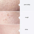 Aqua Peel Solution Set — AS1 SA2 AO3 - View 5