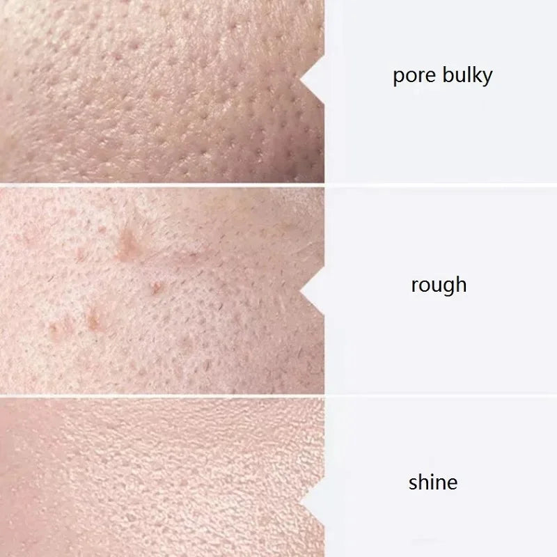 Aqua Peel Solution Set — AS1 SA2 AO3 - View 15