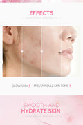 LAIKOU Sakura Moisturizing Kit — 5 Piece - View 10