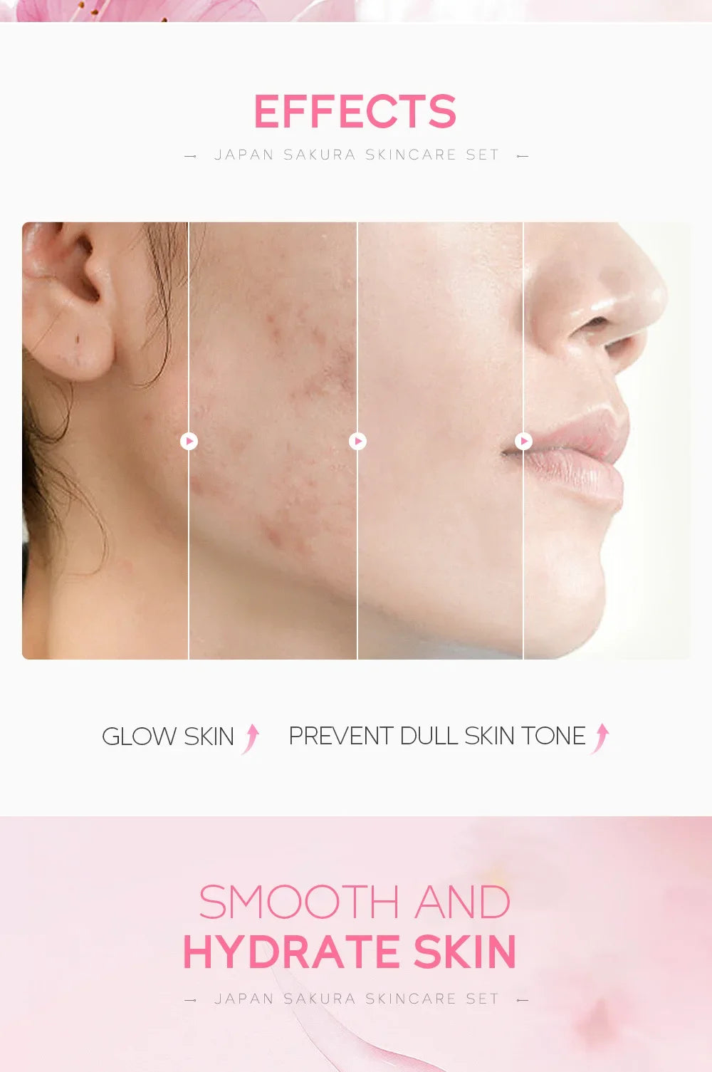 LAIKOU Sakura Moisturizing Kit — 5 Piece - View 10